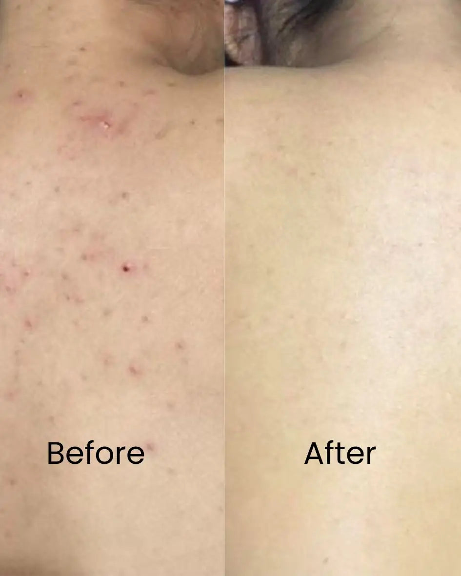 Surface Reset Body Cleanser