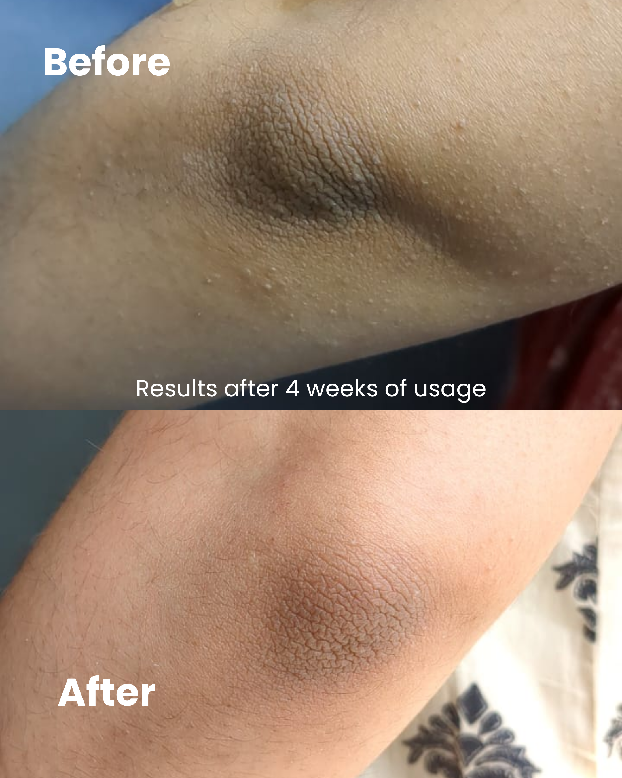 De-tan Bundle