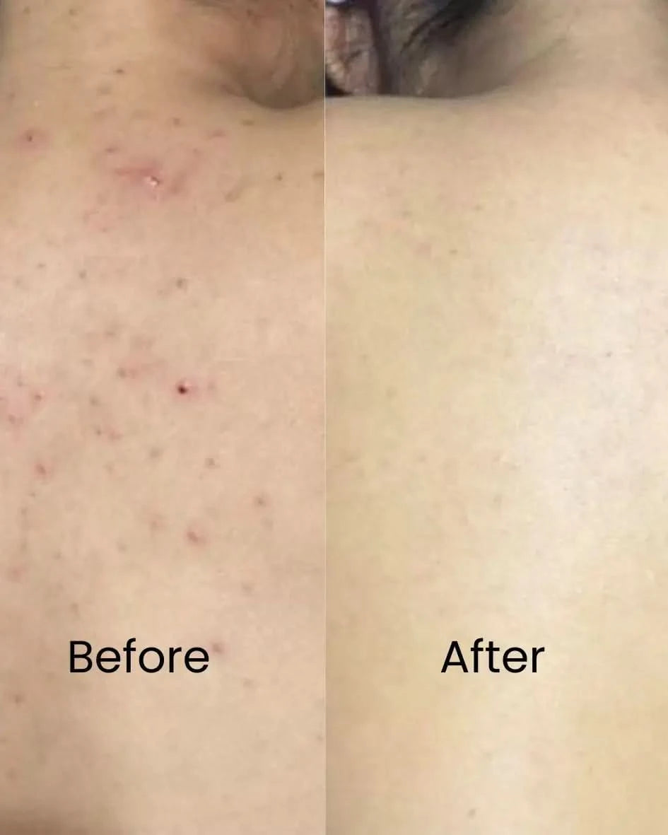 Surface Reset Body Cleanser