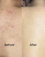 Surface Reset Body Cleanser